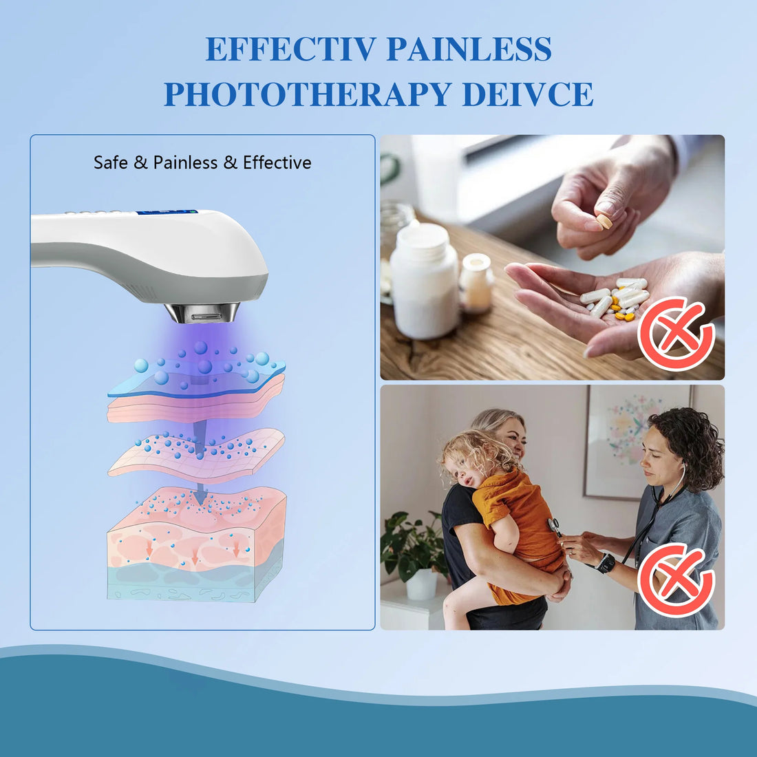 Handheld UVB Phototherapy Device for Vitiligo & Psoriasis - Portable 308nm Light Therapy Lamp by UVBtreatment