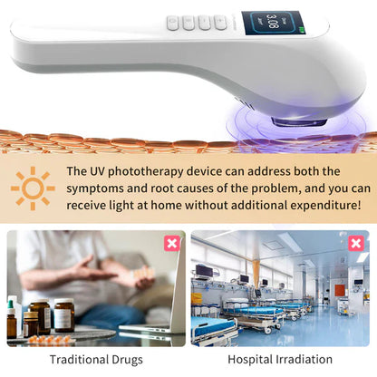 UVBtreatment Handheld UVB Vitiligo/Psoriasis Light Therapy Device
