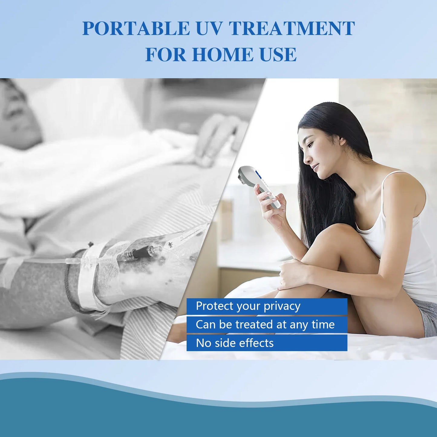UVBtreatment Handheld UVB Vitiligo/Psoriasis Light Therapy Device
