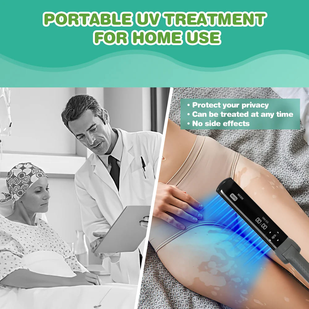 UVBtreatment Targeted Narrowband UVB Therapy Device