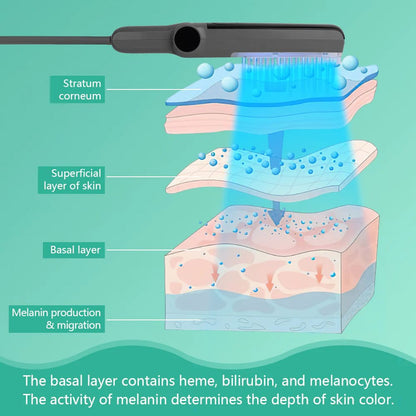 UVBtreatment Targeted Narrowband UVB Therapy Device
