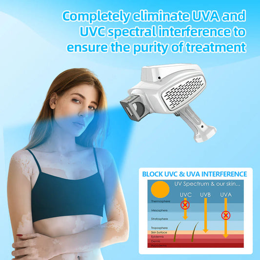 UVBtreatment 308nm Targeted Phototherapy Device for Home