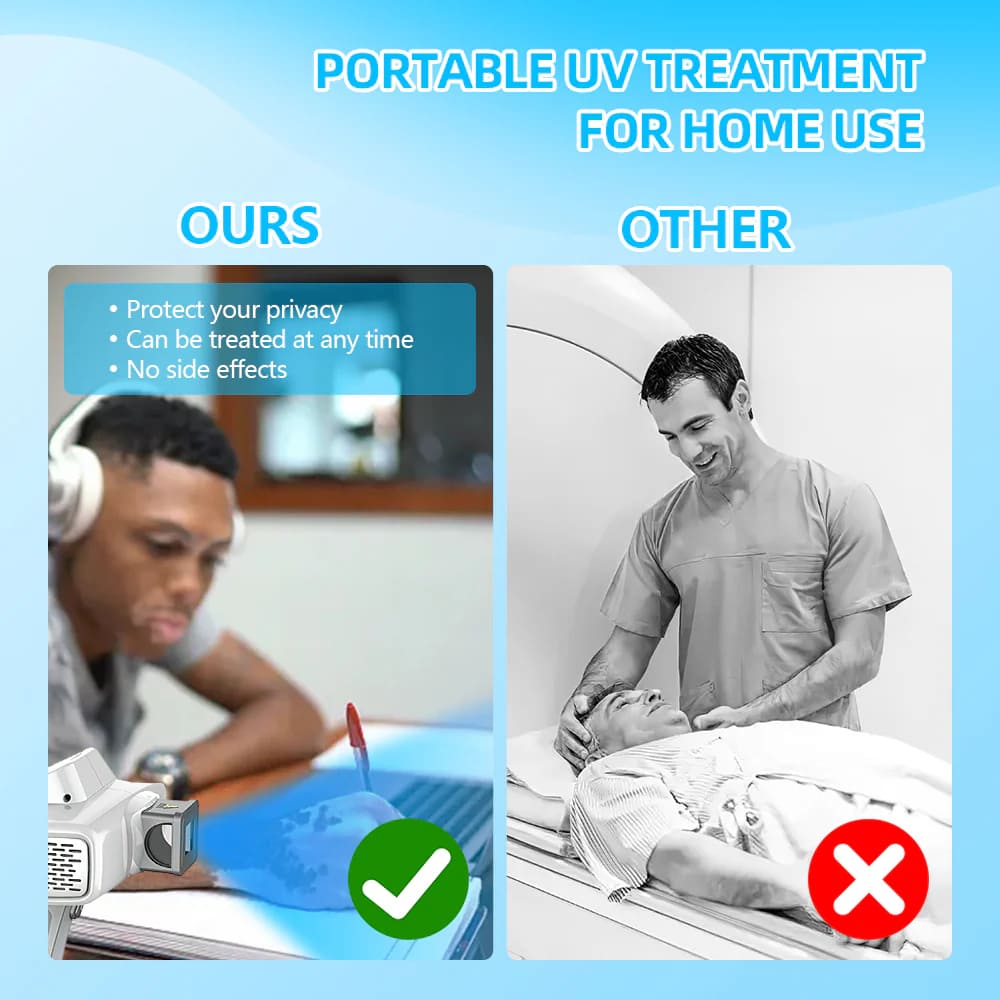 UVBtreatment 308nm Targeted Phototherapy Device for Home