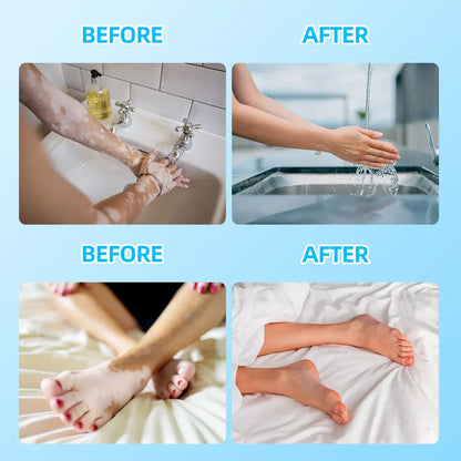 UVBtreatment 308nm Targeted Phototherapy Device for Home